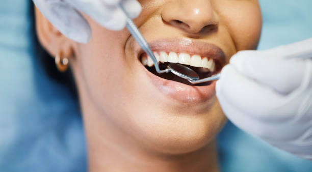 Best Broken or Chipped Tooth Repair in Garden Home Whitfd, OR
