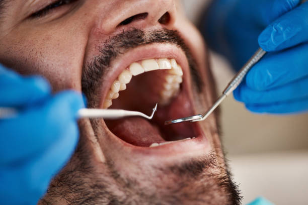 Best Emergency Denture Repair in Garden Home Whitfd, OR